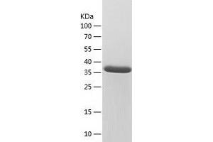Western Blotting (WB) image for Oligonucleotide/oligosaccharide-Binding Fold Containing 1 (OBFC1) (AA 1-368) protein (His-IF2DI Tag) (ABIN7124258)