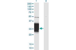 Western Blot analysis of ZNF428 expression in transfected 293T cell line by ZNF428 monoclonal antibody (M01), clone 3H4. (ZNF428 anticorps  (AA 1-188))