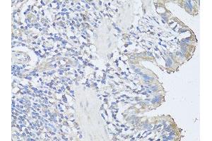 Immunohistochemistry of paraffin-embedded rat lung using CASP3 antibody (ABIN6292881) at dilution of 1:100 (40x lens). (Caspase 3 anticorps)