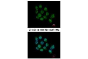 ICC/IF Image Immunofluorescence analysis of paraformaldehyde-fixed A431, using DDX5, antibody at 1:500 dilution. (DDX5 anticorps  (C-Term))