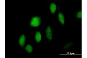 Immunofluorescence of purified MaxPab antibody to ZNF473 on HeLa cell. (ZNF473 anticorps  (AA 1-871))