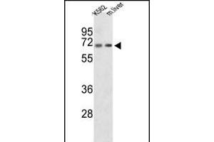 Western blot analysis of CROT Antibody (N-term) (ABIN653328 and ABIN2842818) in K562 cell line and mouse liver tissue lysates (35 μg/lane). (CROT anticorps  (N-Term))