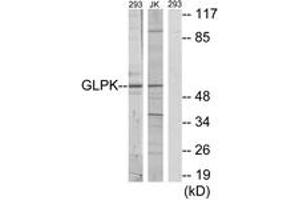 Western blot analysis of extracts from 293/Jurkat cells, using GK Antibody. (Glycerol Kinase anticorps  (AA 461-510))