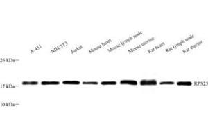 Western blot analysis of RPS25 (ABIN7075449)at dilution of 1: 1000 (RPS25 anticorps)