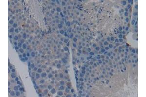 DAB staining on IHC-P; Samples: Mouse Testis Tissue (Caspase 9 anticorps  (AA 1-200))