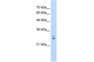 WB Suggested Anti-KCTD11 Antibody Titration:  1. (KCTD11 anticorps  (N-Term))