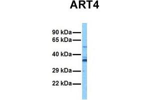 Host:  Rabbit  Target Name:  ART4  Sample Tissue:  Human Stomach Tumor  Antibody Dilution:  1. (ART4 anticorps  (Middle Region))