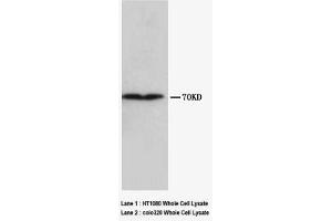 Image no. 1 for anti-Collagen, Type III (COL3) antibody (Magnetic Particles) (ABIN1496270)