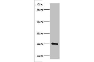 Western blot All lanes: Protein DGCR6L antibody at 2 μg/mL + Mouse brain tissue Secondary Goat polyclonal to rabbit IgG at 1/10000 dilution Predicted band size: 25 kDa Observed band size: 25 kDa