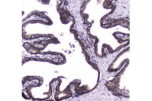 IHC analysis of WWOX using anti-WWOX antibody . (WWOX anticorps  (AA 1-245))