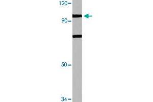 Western blot analysis of HeLa cell lysate with N4BP1 polyclonal antibody  at 1:500 dilution. (N4BP1 anticorps)