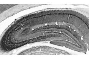 Adult rat hippocampus immunohistochemistry.