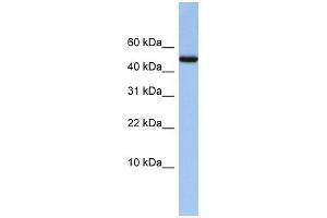 ABAT antibody used at 1 ug/ml to detect target protein. (ABAT anticorps  (Middle Region))