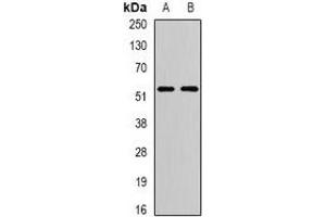 Western blot analysis of ATG13 expression in T47D (A), SW480 (B) whole cell lysates. (ATG13 anticorps)
