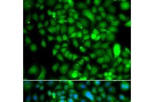 Immunofluorescence analysis of A549 cells using CSRP2BP Polyclonal Antibody (CSRP2BP anticorps)