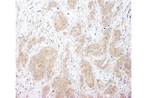 anti-Sorting Nexin 1 (SNX1) (C-Term) antibody