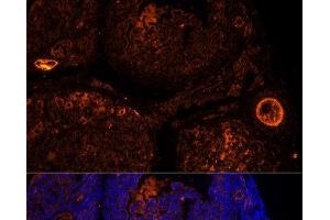 Immunofluorescence analysis of Mouse oophoroma cells using ZP2 Polyclonal Antibody at dilution of 1:100.