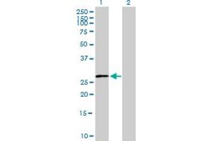 Western Blot analysis of HSD11B1 expression in transfected 293T cell line by HSD11B1 MaxPab polyclonal antibody. (HSD11B1 anticorps  (AA 1-292))