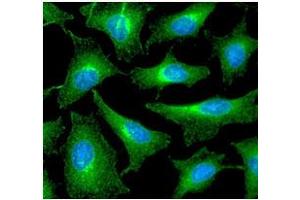 ICC/IF analysis of PRDX6 in HeLa cells line, stained with DAPI (Blue) for nucleus staining and monoclonal anti-human PRDX6 antibody (1:100) with goat anti-mouse IgG-Alexa fluor 488 conjugate (Green).