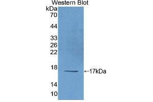 Figure. (EIF2D anticorps  (AA 1-117))