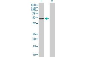 Western Blot analysis of TYMP expression in transfected 293T cell line by TYMP MaxPab polyclonal antibody. (Thymidine Phosphorylase anticorps  (AA 1-482))