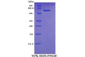 SDS-PAGE (SDS) image for Activated Leukocyte Cell Adhesion Molecule (ALCAM) (AA 28-527) protein (His tag) (ABIN1078731)