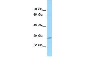 WB Suggested Anti-REP15 Antibody Titration: 1.