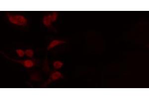 ABIN6272443 staining RAW264. (TCFL5 anticorps  (C-Term))