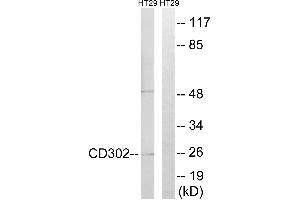 Immunohistochemistry analysis of paraffin-embedded human lymph node tissue using CD302 antibody. (DCL1 anticorps)
