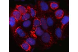 IF analysis of SPACA3 using anti-SPACA3 antibody (ABIN7602569).