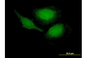 Immunofluorescence of purified MaxPab antibody to PHLDA1 on HeLa cell. (PHLDA1 anticorps  (AA 1-259))