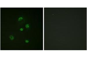 Immunofluorescence analysis of A549 cells, using CHOP (Phospho-Ser30) Antibody. (DDIT3 anticorps  (pSer30))