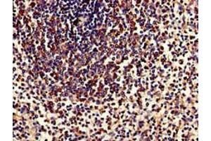 Immunohistochemistry of paraffin-embedded human spleen tissue using ABIN7173913 at dilution of 1:100