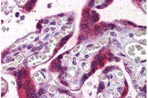 Human Placenta: Formalin-Fixed, Paraffin-Embedded (FFPE)