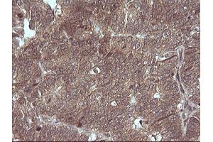 Image no. 2 for anti-Mitogen-Activated Protein Kinase Kinase 3 (MAP2K3) antibody (ABIN1499406) (MAP2K3 anticorps)
