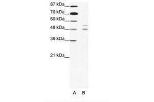 Image no. 1 for anti-Microphthalmia-Associated Transcription Factor (MITF) (N-Term) antibody (ABIN203124) (MITF anticorps  (N-Term))