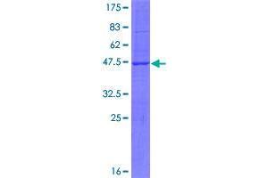 Image no. 1 for Strawberry Notch Homolog 1 (SBNO1) (AA 1-181) protein (GST tag) (ABIN1319187)