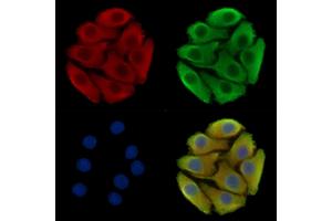 ABIN7096638 and ABIN7100703 staining Hela cells by IF/ICC. (Bax Inhibitor 1 anticorps)