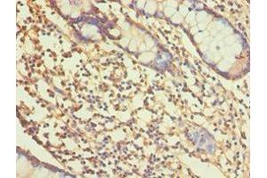 Immunohistochemistry of paraffin-embedded human small intestine tissue using ABIN7167765 at dilution of 1:100