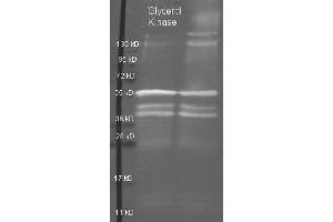Goat anti Glycerol Kinase antibody  was used to detect purified Glycerol Kinase under reducing (R) and non-reducing (NR) conditions.