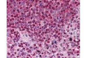 Immunohistochemistry (IHC) image for anti-Tumor Necrosis Factor Receptor Superfamily, Member 13B (TNFRSF13B) (AA 116-132) antibody (ABIN2470171)