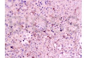 Formalin-fixed and paraffin embedded mouse lymphoma tissue labeled Anti-CD8 Polyclonal Antibody, Unconjugated (ABIN671391) at 1:200, followed by conjugation to the secondary antibody and DAB staining (CD8 anticorps  (AA 51-150))