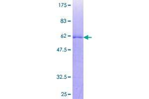 Image no. 1 for TP53 Target 5 (TP53TG5) (AA 1-290) protein (GST tag) (ABIN1323396)