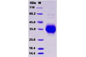Western Blotting (WB) image for Tumor Necrosis Factor Receptor Superfamily, Member 1A (TNFRSF1A) (Active) protein (His tag) (ABIN7198475)