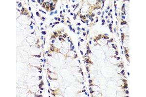 Immunohistochemistry of paraffin-embedded Human colon using CAND1 Polyclonal Antibody at dilution of 1:100 (40x lens). (CAND1 anticorps)