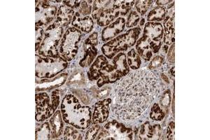 Immunohistochemical staining of human kidney with C1orf109 polyclonal antibody  shows strong cytoplasmic positivity in cells of renal tubles. (C1ORF109 anticorps)