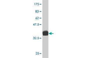 Western Blot detection against Immunogen (36. (LIM Domain Kinase 1 anticorps  (AA 548-647))