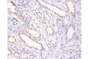 Immunohistochemistry of paraffin-embedded human kidney tissue using ABIN7145696 at dilution of 1:100 (BMP6 anticorps  (AA 382-513))