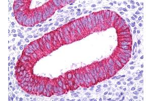 Anti-KRT18 / Cytokeratin 18 antibody IHC of human uterus, endometrium.