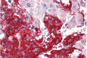 ABIN190848 (5µg/ml) staining of paraffin embedded Human Adrenal Gland.